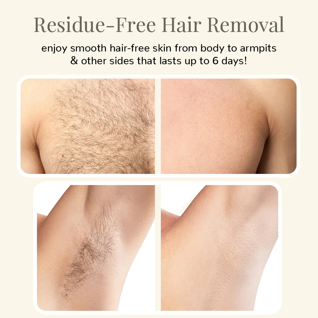 Klyssa Painless Body Hair Removal Cream