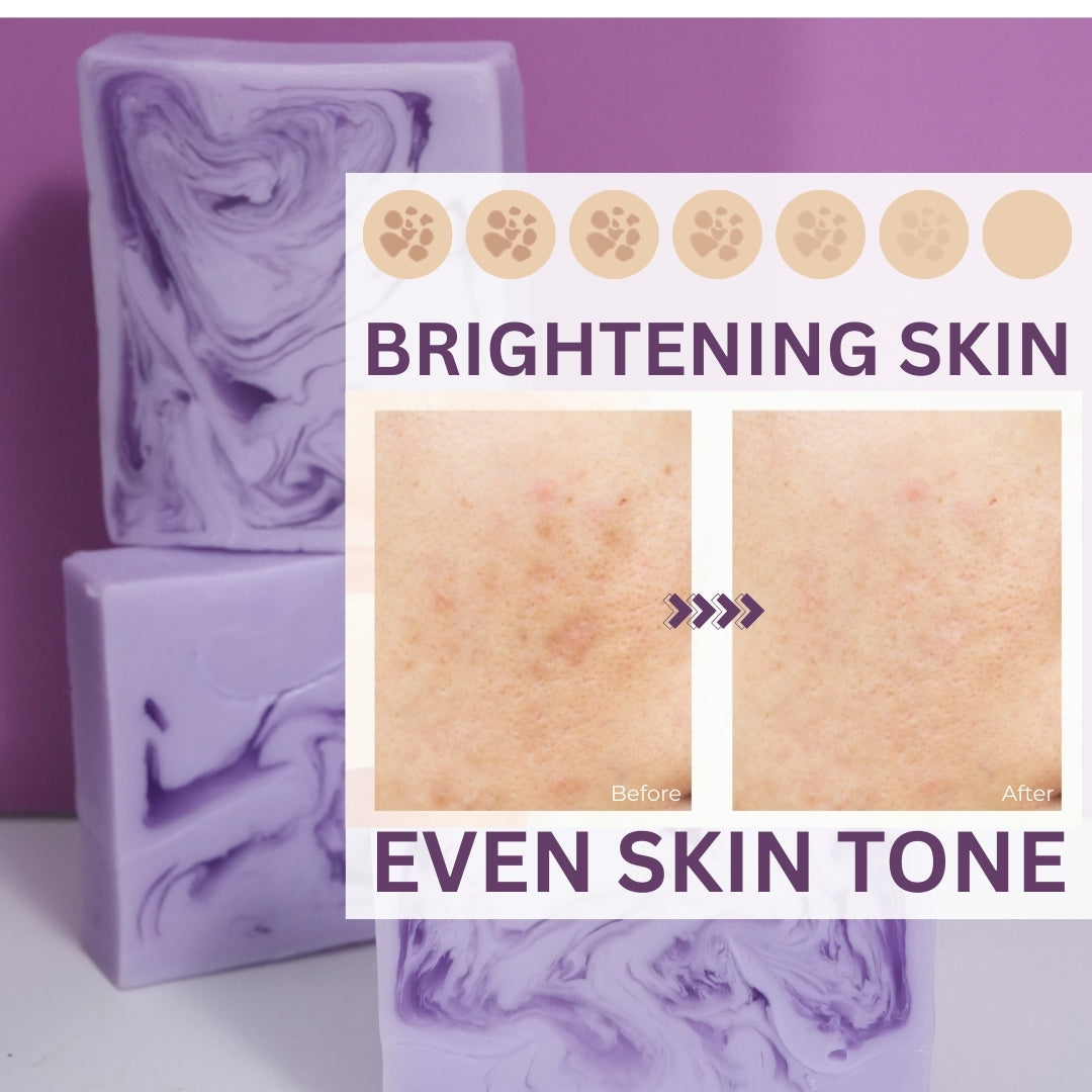 Klyssa Lavender & Kojic Acid Soap